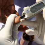 RBC health worker advising a patient about diabetes prevention and testing in Rwanda.