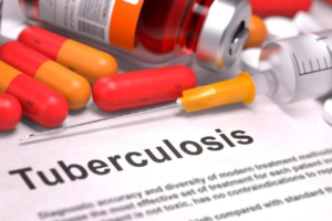 Health workers screening patients for tuberculosis in Rwanda using modern diagnostic equipment