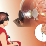 vision technology
