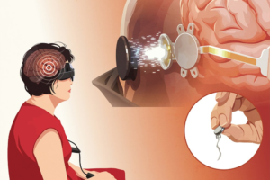 vision technology