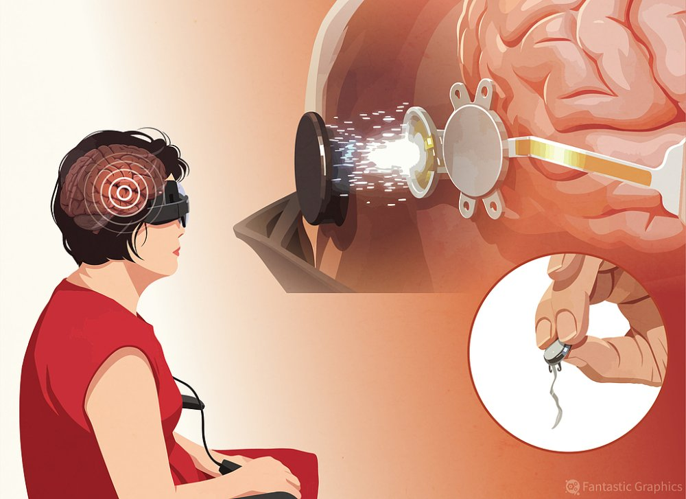 vision technology
